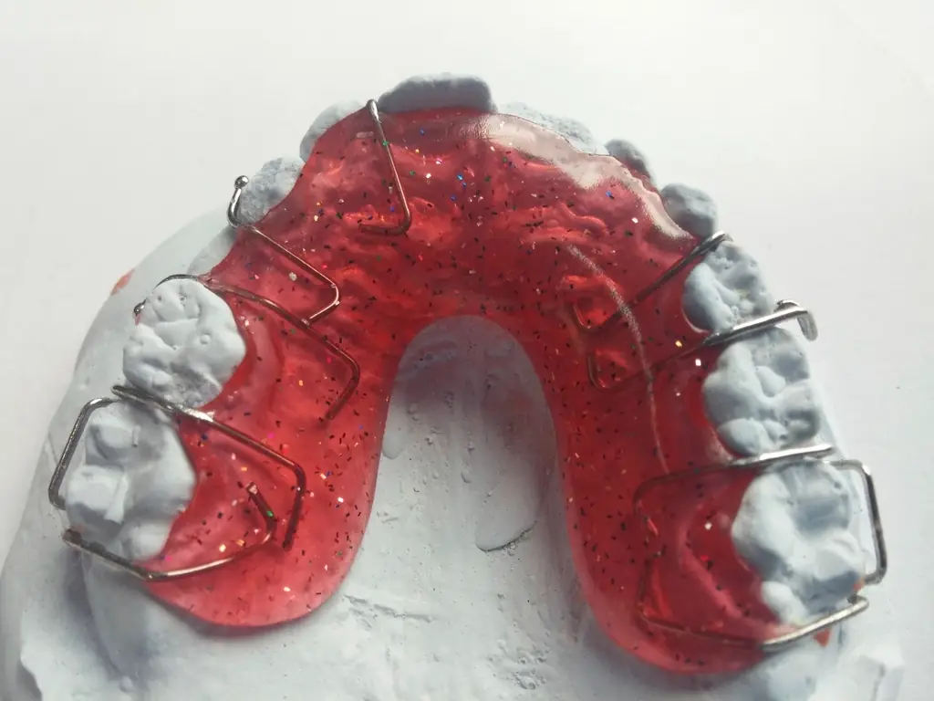 Periodoncia (foto de ejemplo)